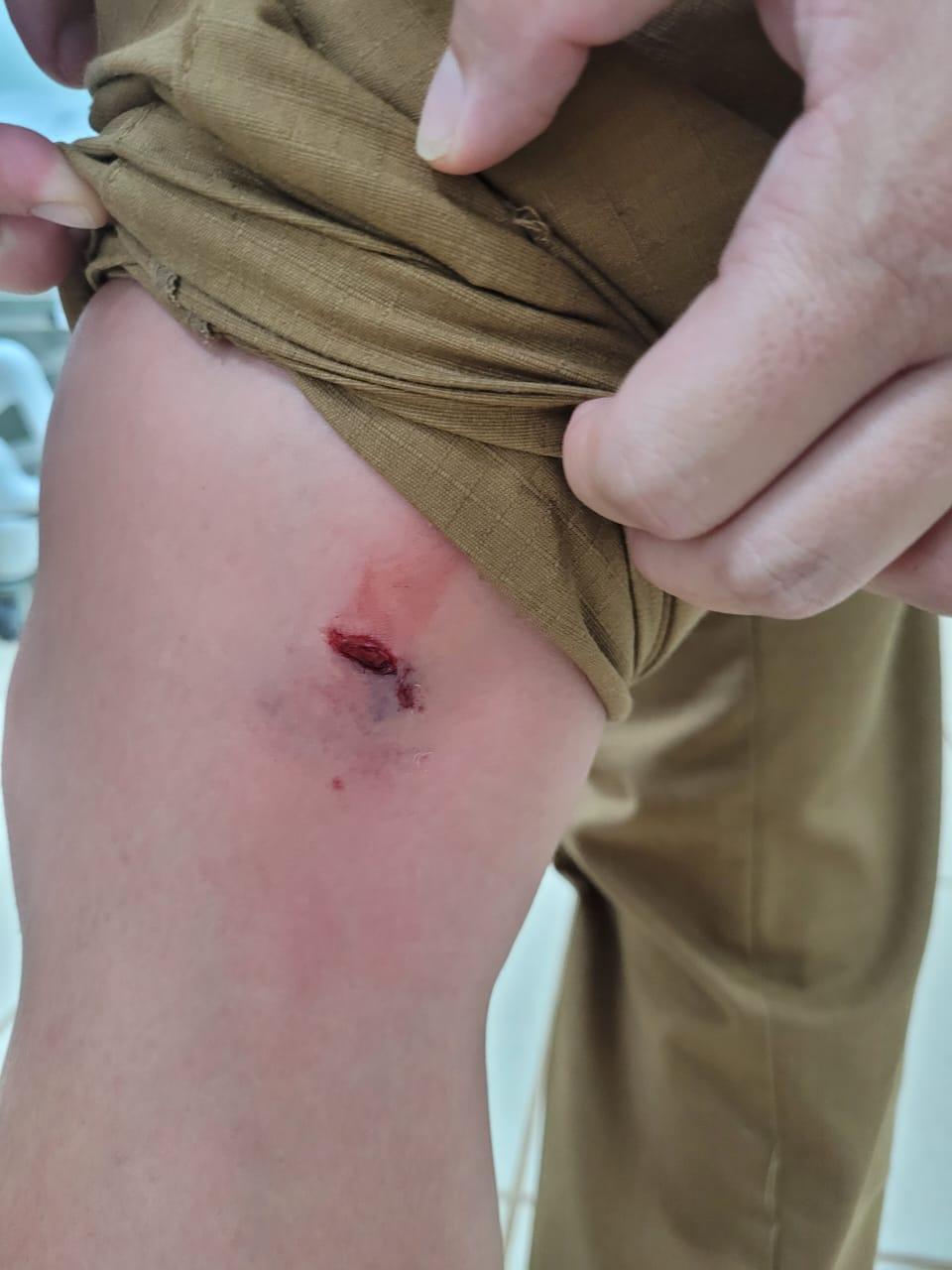 Policiais ficam feridos durante prisão de rapaz que tentava praticar furto em Santa Helena