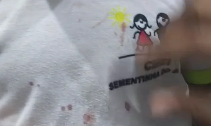 Criança de 2 anos chega à creche com graves ferimentos e padrasto é preso em Palotina